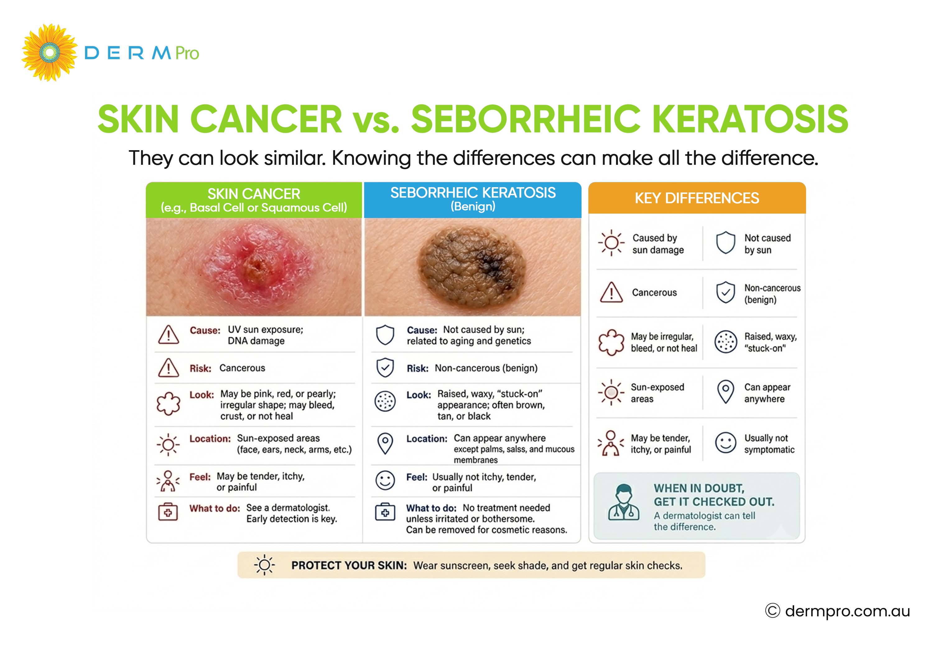 Skin Cancer vs Seborrheic Keratosis